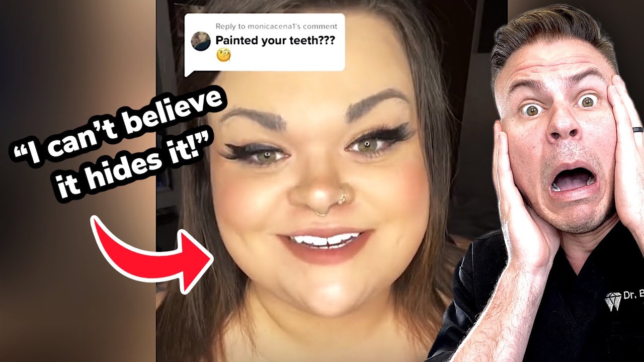 She Painted Her Teeth White.. What Was Underneath Will SHOCK You 😳