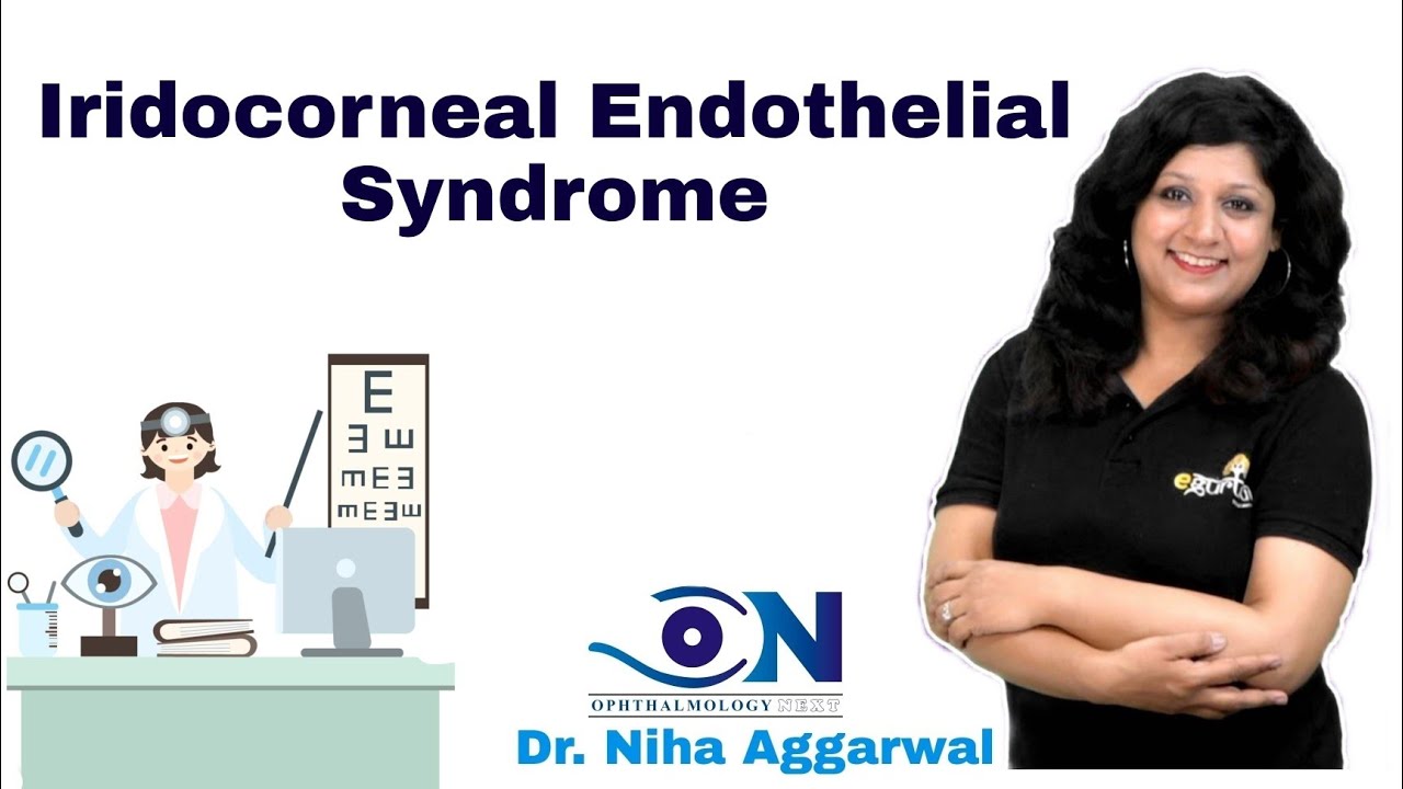 Iridocorneal Endothelial Syndrome || Dr. Niha Aggarwal