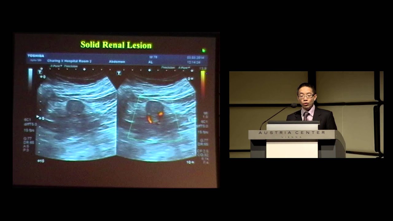 Prof. A. Lim: Abdominal and high-frequency ultrasound imaging