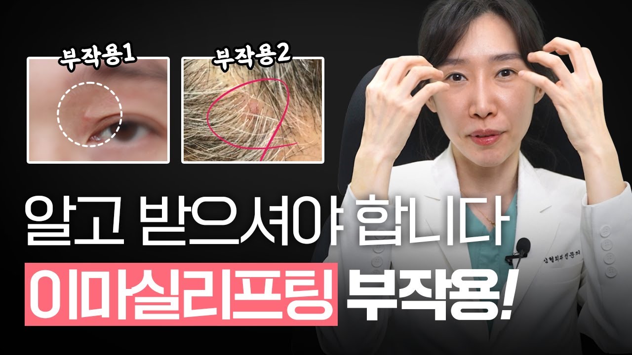 [SUB] 이마실리프팅 부작용? 알고 받으셔야 합니다! (feat. 실제 케이스) ㅣ 부작용 예방법까지