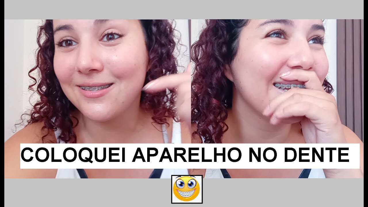 COLOQUEI APARELHO NO DENTE l FIQUEI SUPER NERVOSA PARTE 1 #VLOG