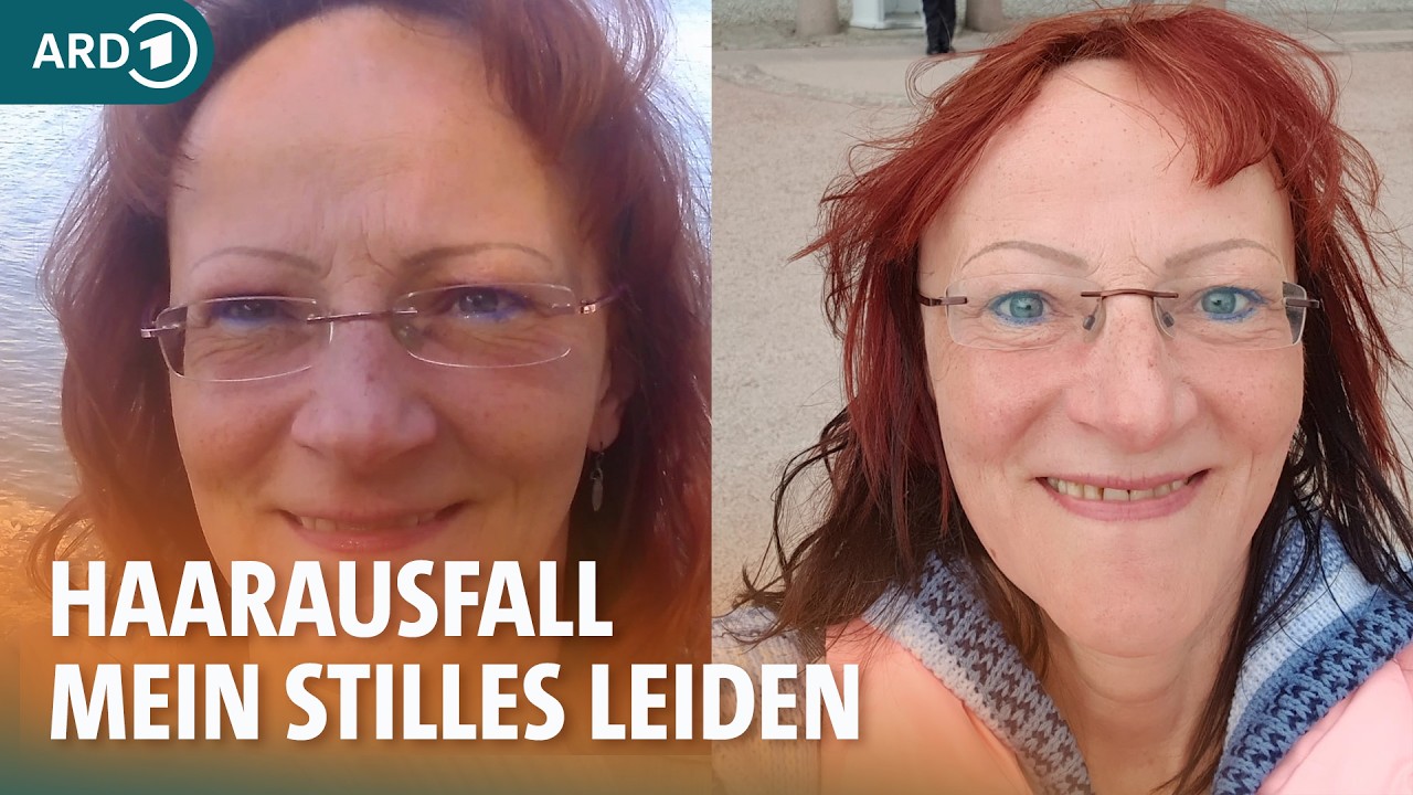 Haartransplantation bei Frauen – jedes gewonnene Haar ist ein Segen I ARD Gesund