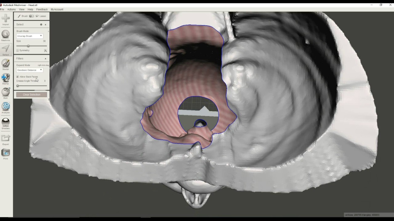 How to Create a Hollow Shell from a Medical STL File Using MeshMixer