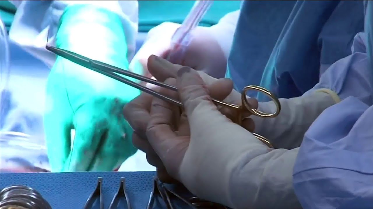 Doctor’s patented technique offers chance for better ankle replacement