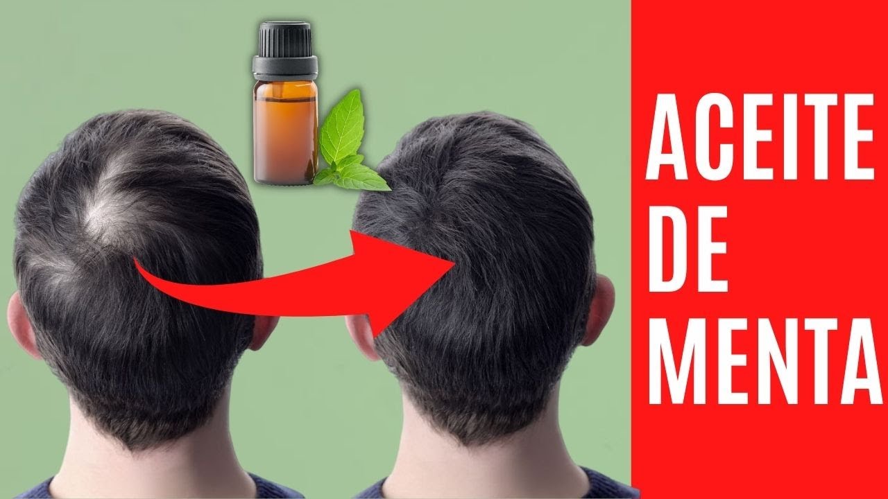 Aceite de Menta VS Minoxidil ⚡¿Cuál es mejor para la alopecia?
