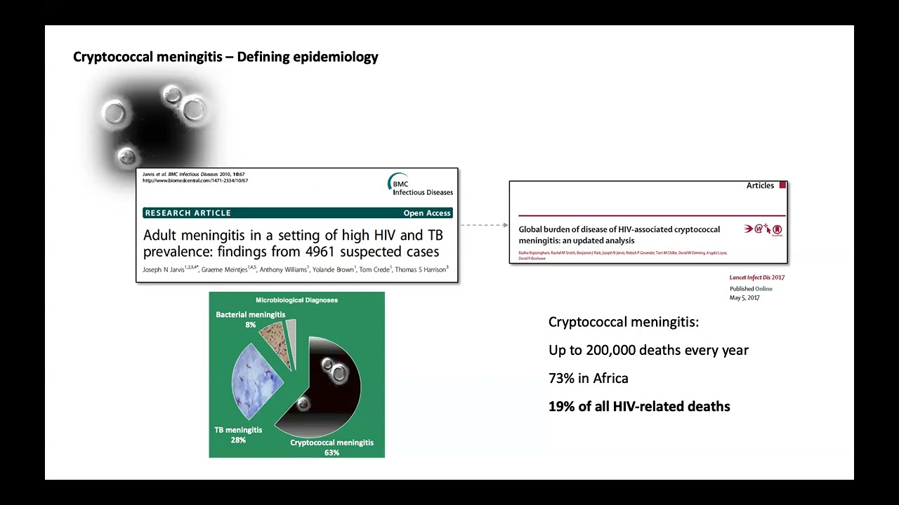 Managing HIV Associated Cryptococcal Meningitis Prof Joe Jarvis 2025