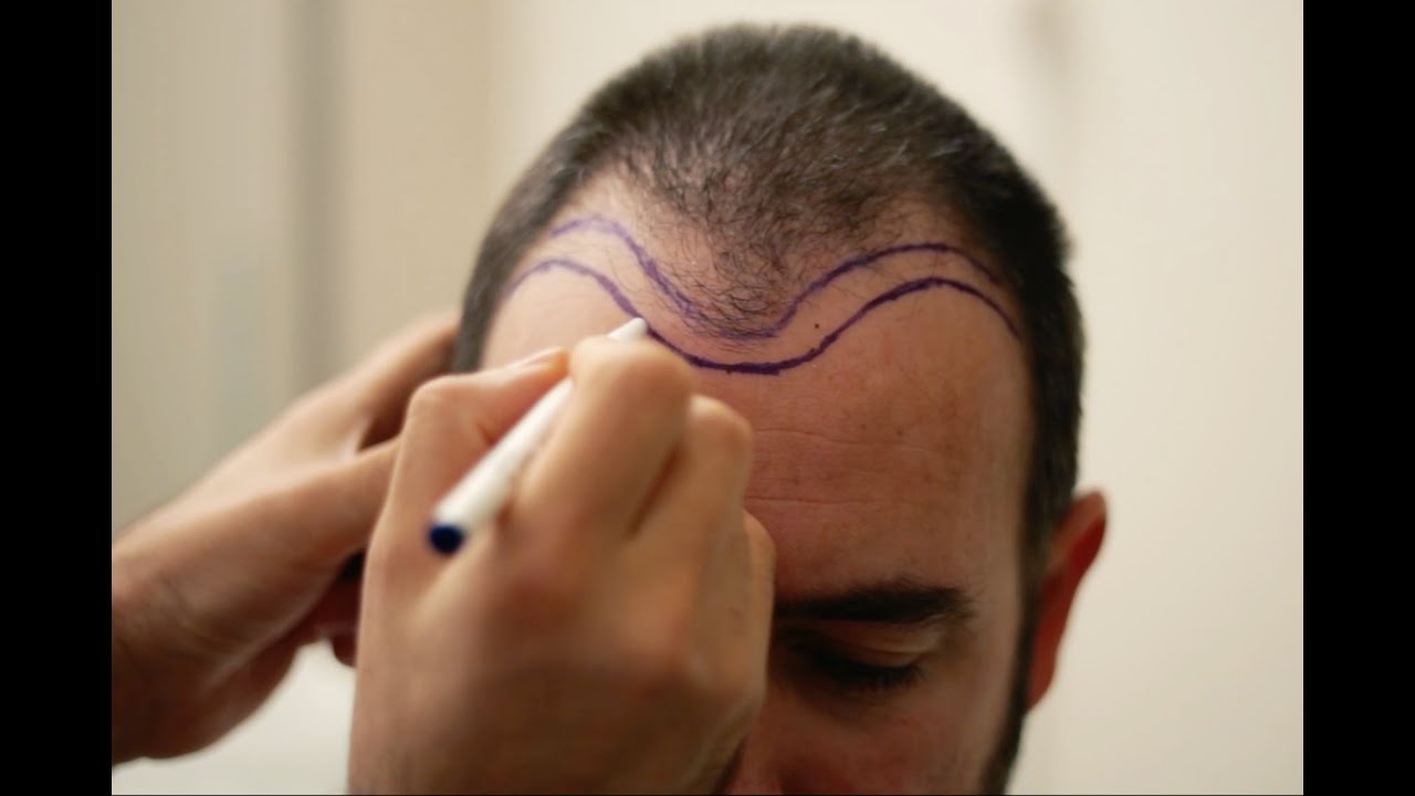 HairNeva - Saç Ekimi SANAT'tır