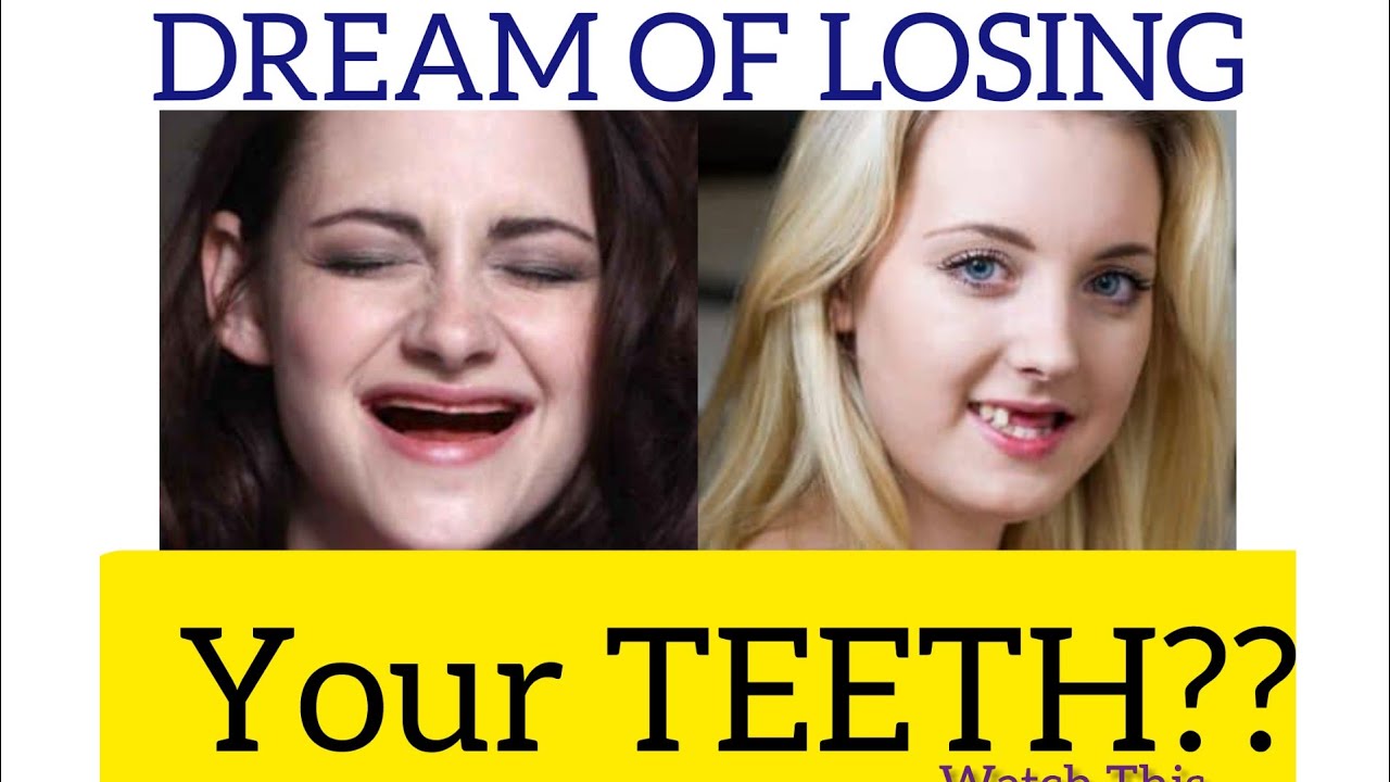 DREAM OF LOSING YOUR TEETH???WATCH THIS