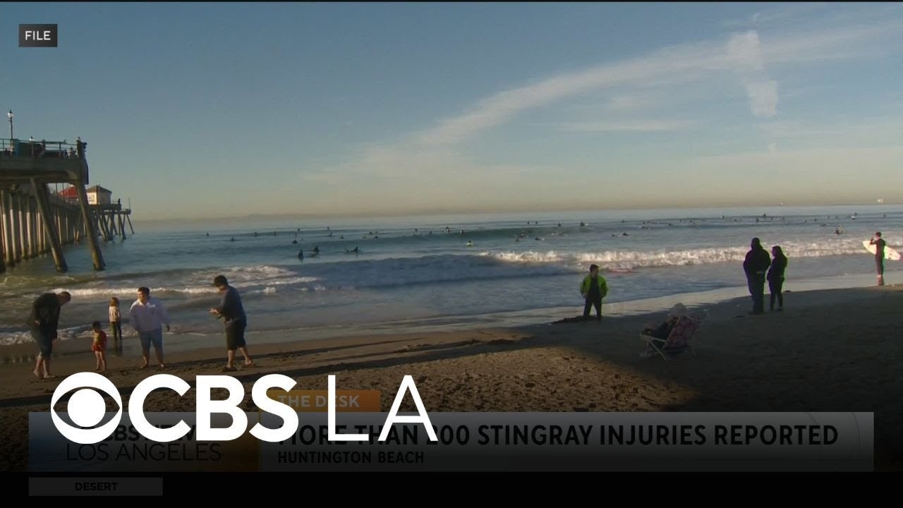 Stingray stings were up over the warm weekend in Huntington Beach
