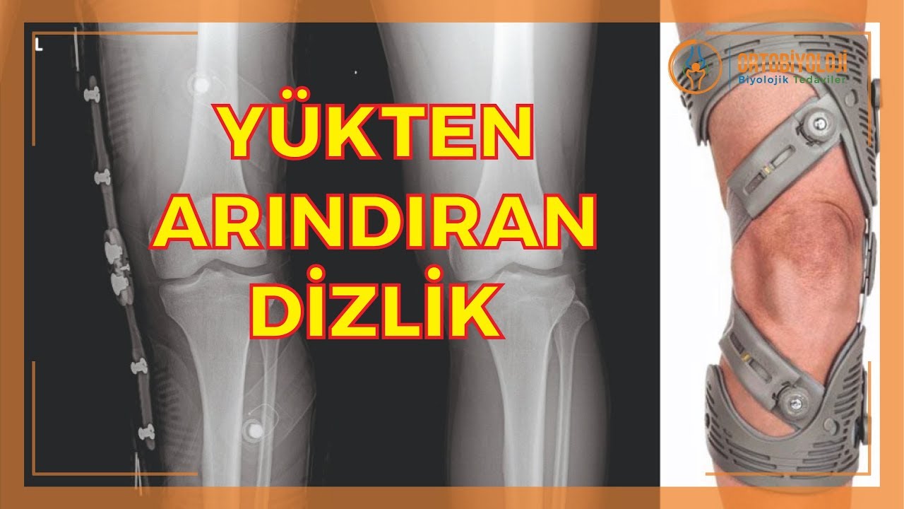 KİŞİYE ÖZEL YÜKTEN ARINDIRAN DİZLİK TEDAVİSİ