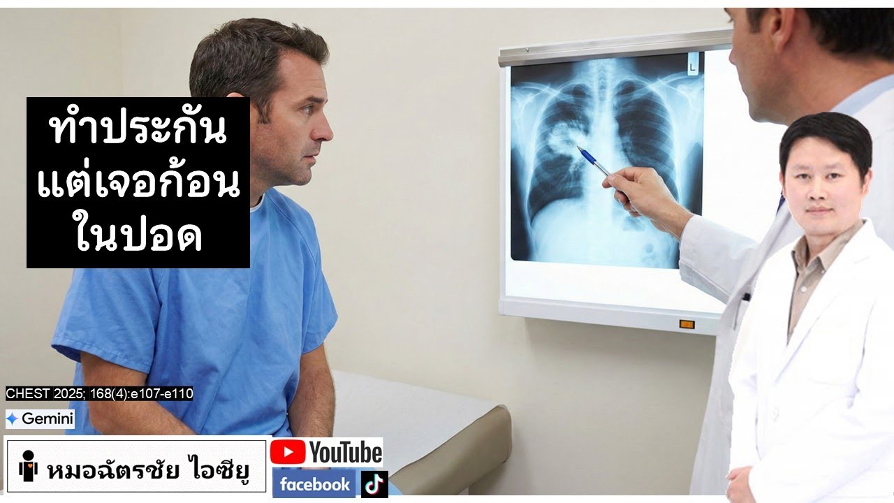 ตรวจสุขภาพทำประกัน ดันเจอ 'ก้อนในอก' ทั้งที่แข็งแรงดี #ทำประกัน #โรคปอด #ไม่มีอาการ