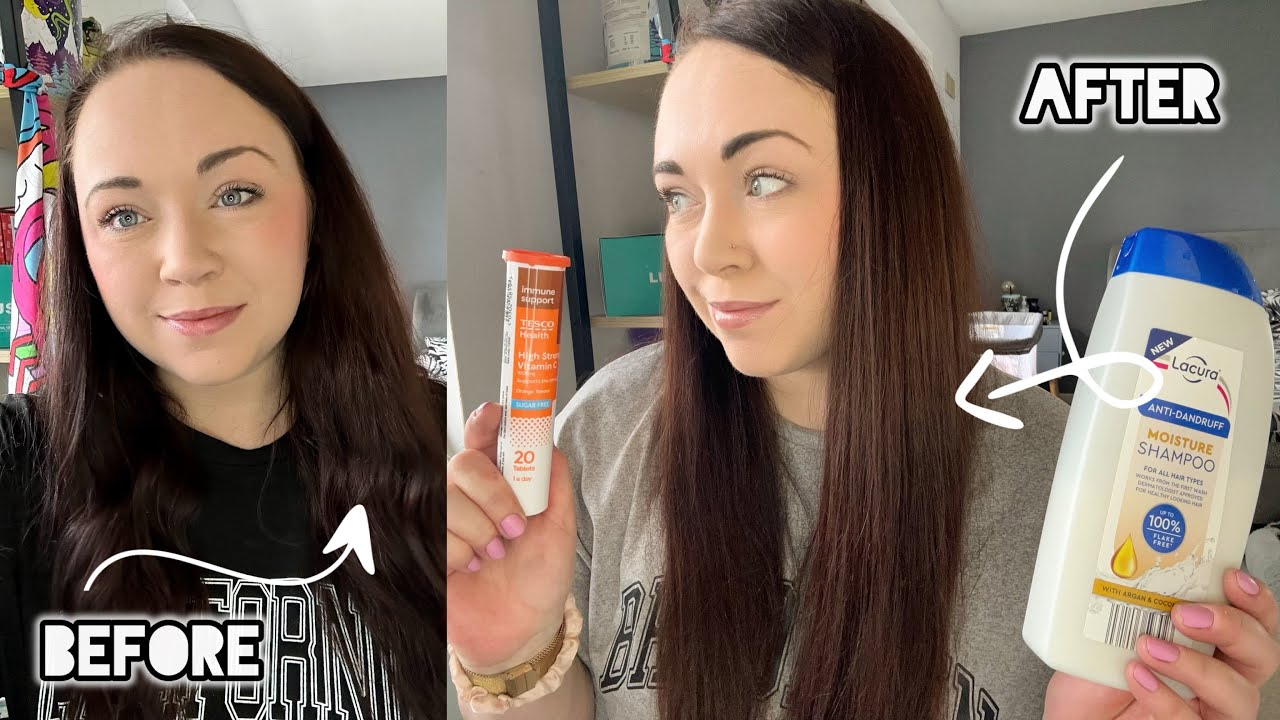 LIGHTEN YOUR HAIR WITH VITAMIN C - No Damage Colour Remover! 🍊