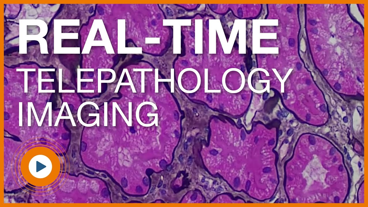 Clinical Pathology Microscope Camera Video Sample