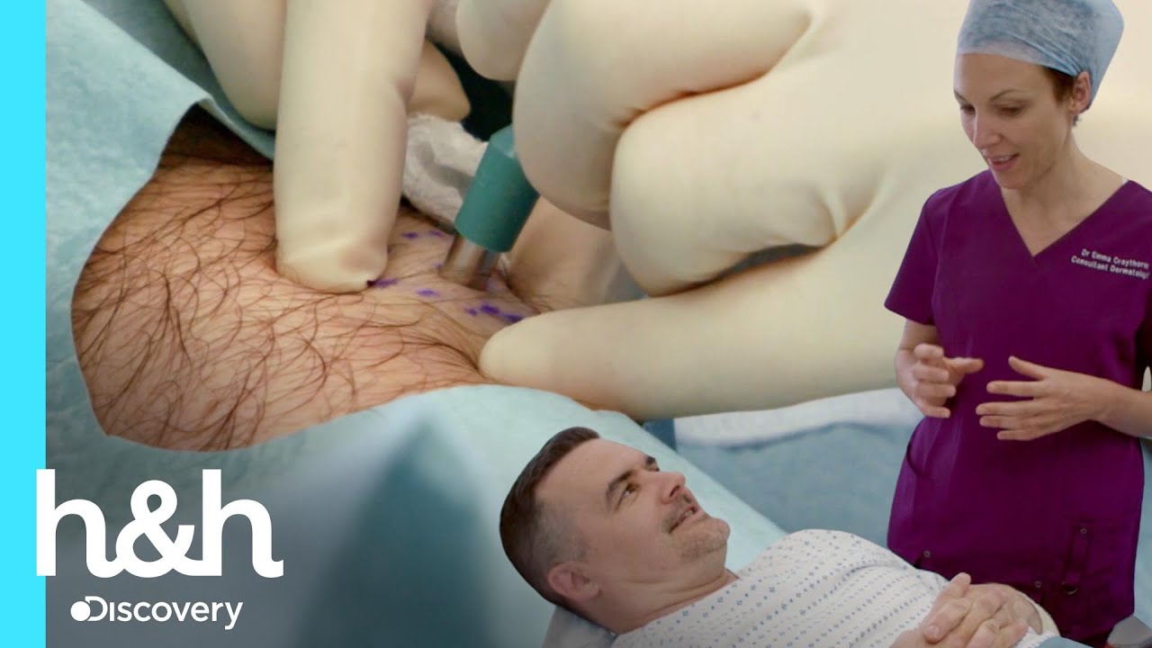 Más de 30 bultos se ocultan bajo su piel | Clínica de la piel | Discovery H&H