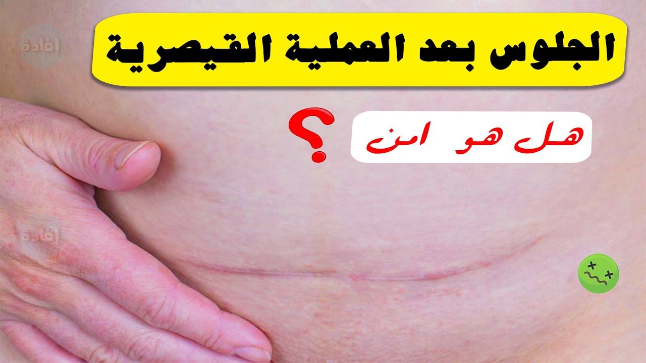 أضرار الجلوس بعد العملية القيصرية ونصائح لتفادي المضاعفات