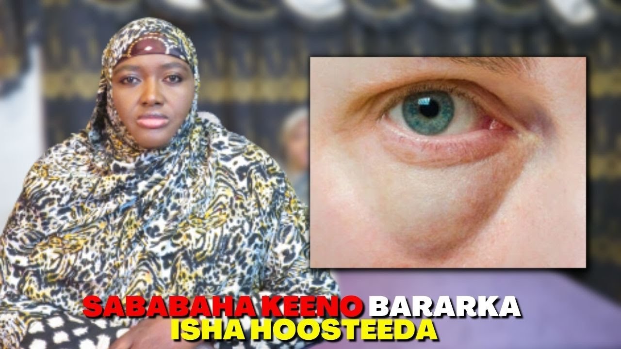MACDANTAAN, HADDII JIRKAAADA AY KA MAQAN-TAHAY WEEY SABABI KARTAA BARARKA ISHA HOOSTEEDA!