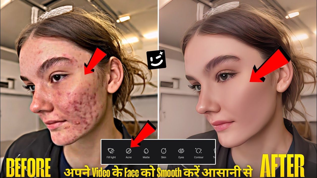 👉 Video में Face Smooth कैसे करें | Remove Pimples & Acne Instantly | Wink App Editing Tutorial 2025