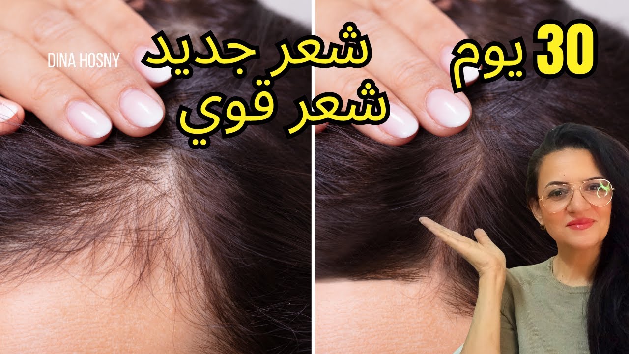 شعر كثيف وصحي في أي عمر | الروتين الكامل #دينا_حسني