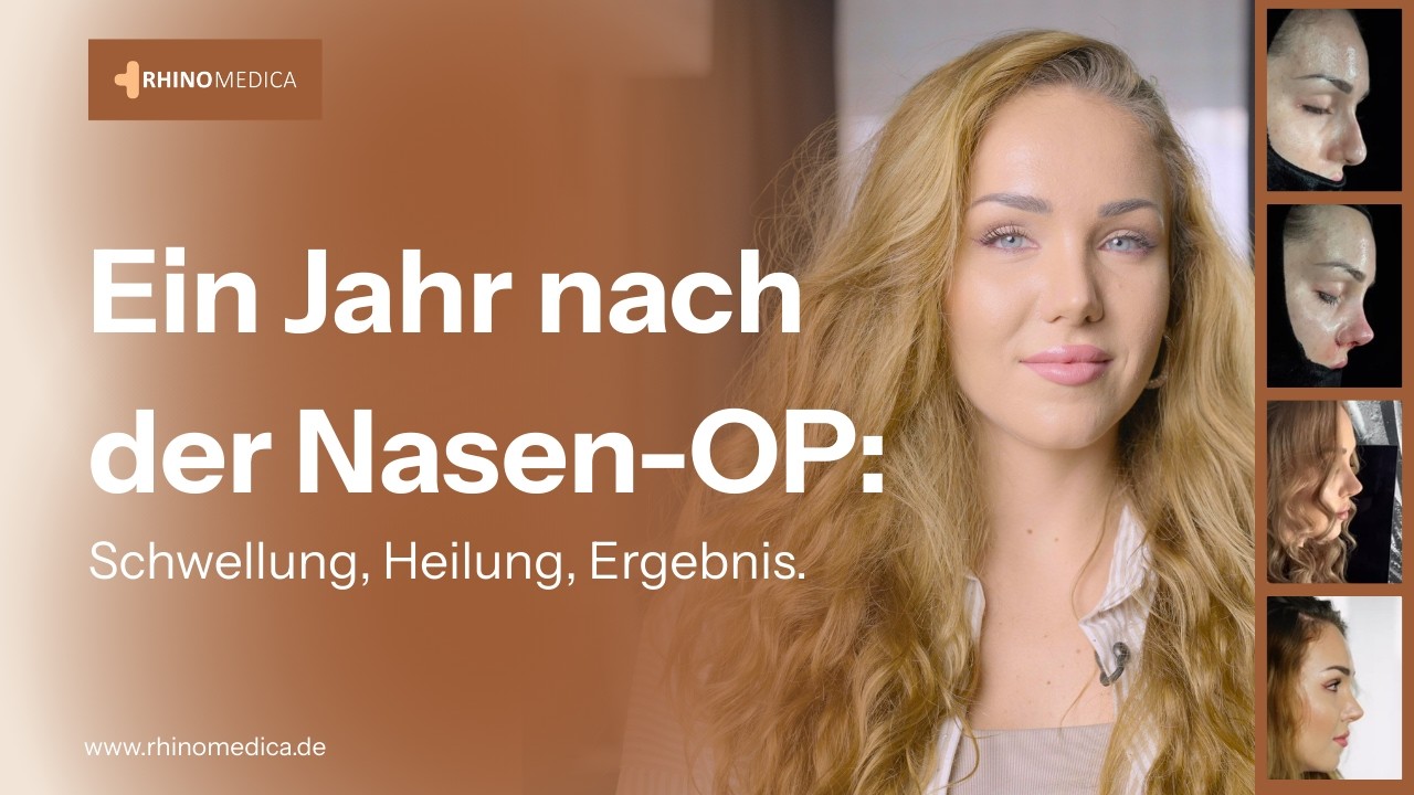 Ein Jahr nach der Nasen-OP: Viktoria über Heilung, Schwellung und das endgültige Ergebnis