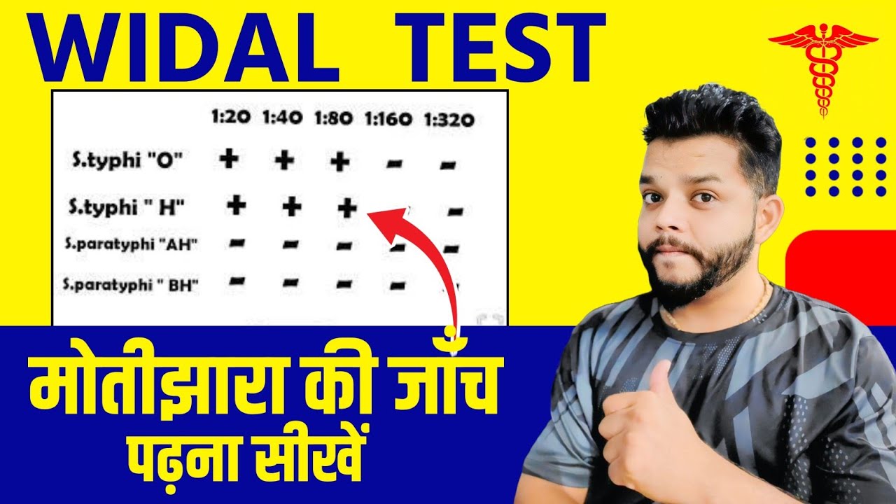 Widal Test कैसे समझे | How To Read Widal Test Report | Typhoid Blood Test