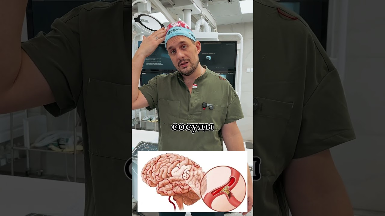 Ты должен это знать чтобы избежать | ИНСУЛЬТ #всеососудах #профилактика #инсульт
