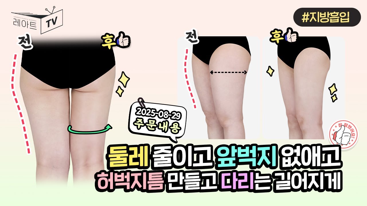 [허벅지 지방흡입] 주문하신 전후사진 모음집 나왔습니다 [레아트성형외과]