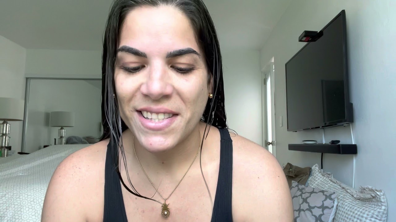 Abdominoplastia - Un año 6 meses Post Op