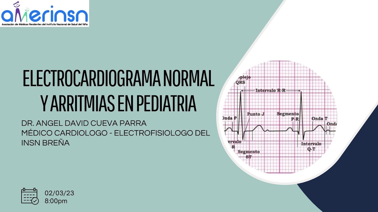 ELECTROCARDIOGRAMA NORMAL Y ARRITMIAS EN PEDIATRIA - DR. ANGEL DAVID CUEVA PARRA