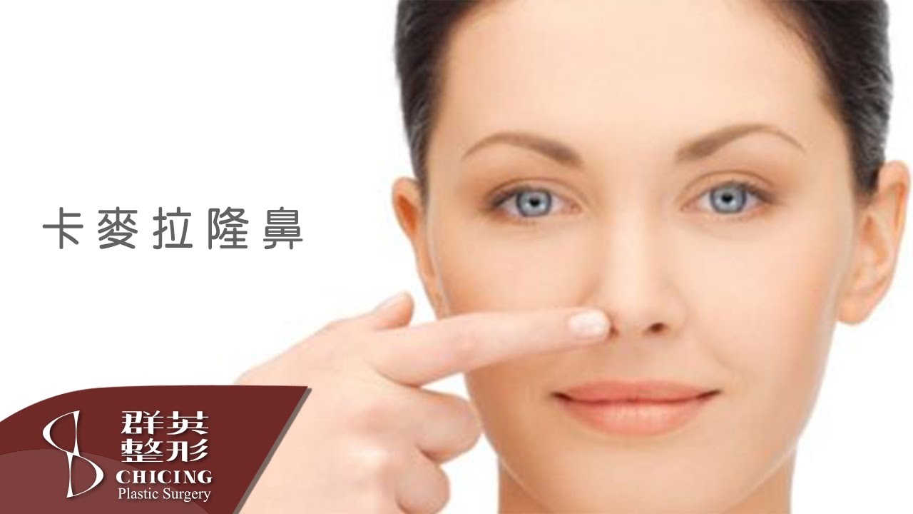 卡麥拉隆鼻│ 姚勝發醫師│【群英整形】