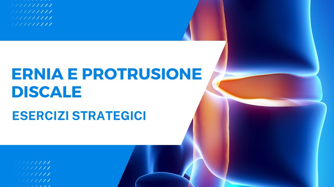 ERNIA E PROTRUSIONE DISCALE esercizi strategici - progressione completa