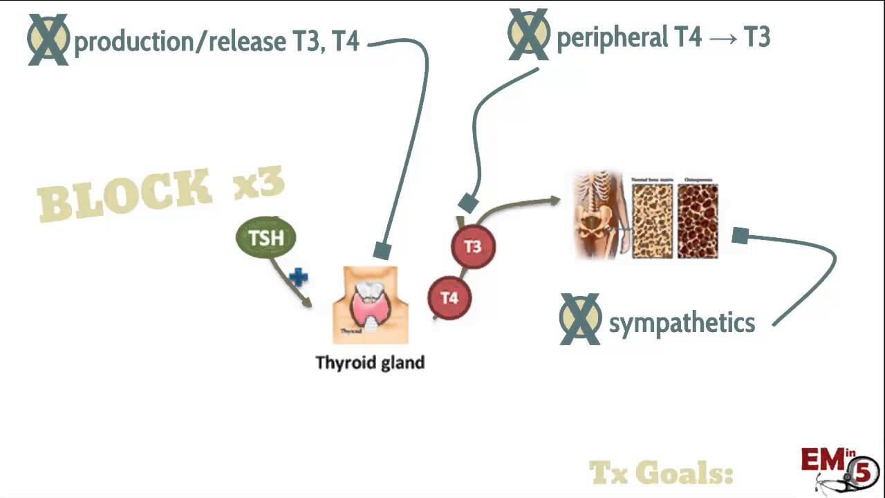 Thyroid Storm