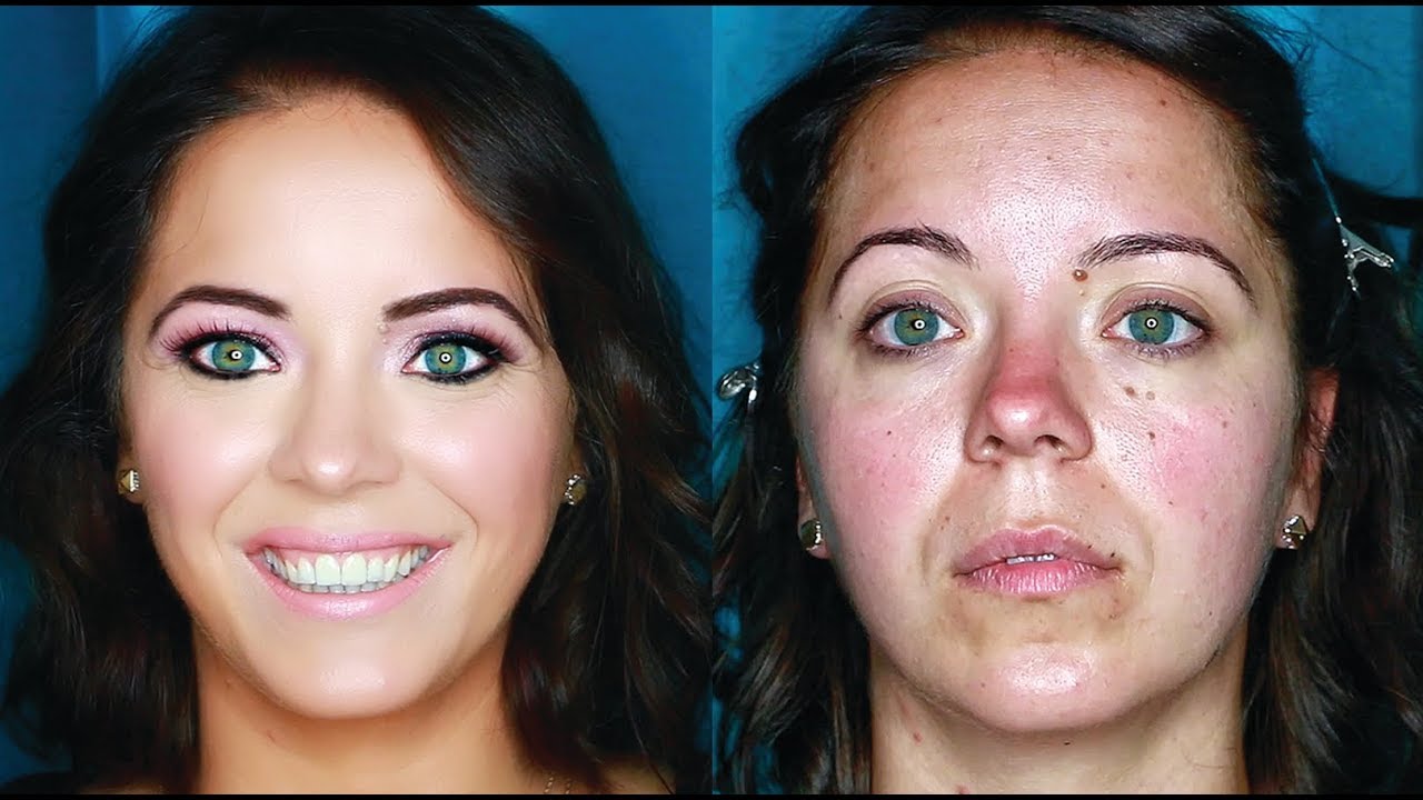 Full Coverage Color Correction for ROSACEA Tips & Tricks for Fall & Winter | mathias4makeup