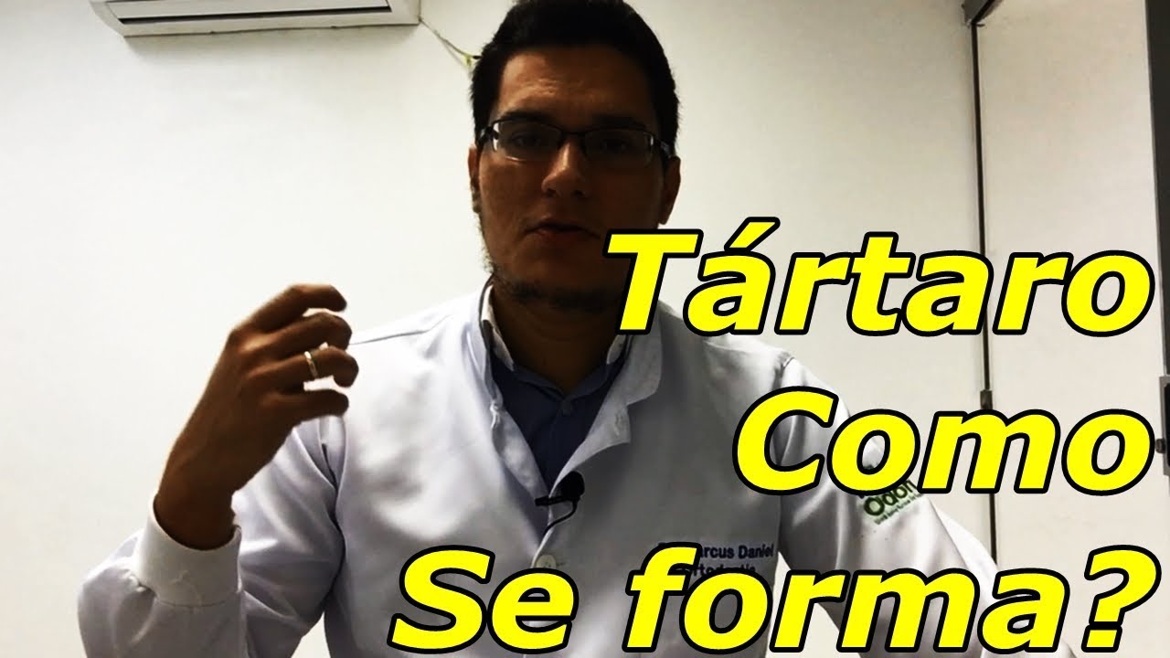 Como se forma a gengivite e o tartaro?