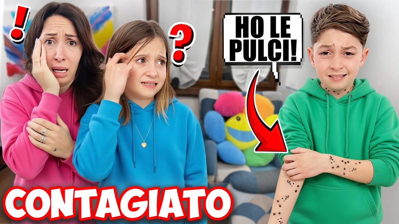 FIGLIODIEGO È STATO PUNTO  IN TUTTO IL CORPO DALLE PULCI NEL NOSTRO CANE ROCKY , CONTAGIA TUTTI ! 