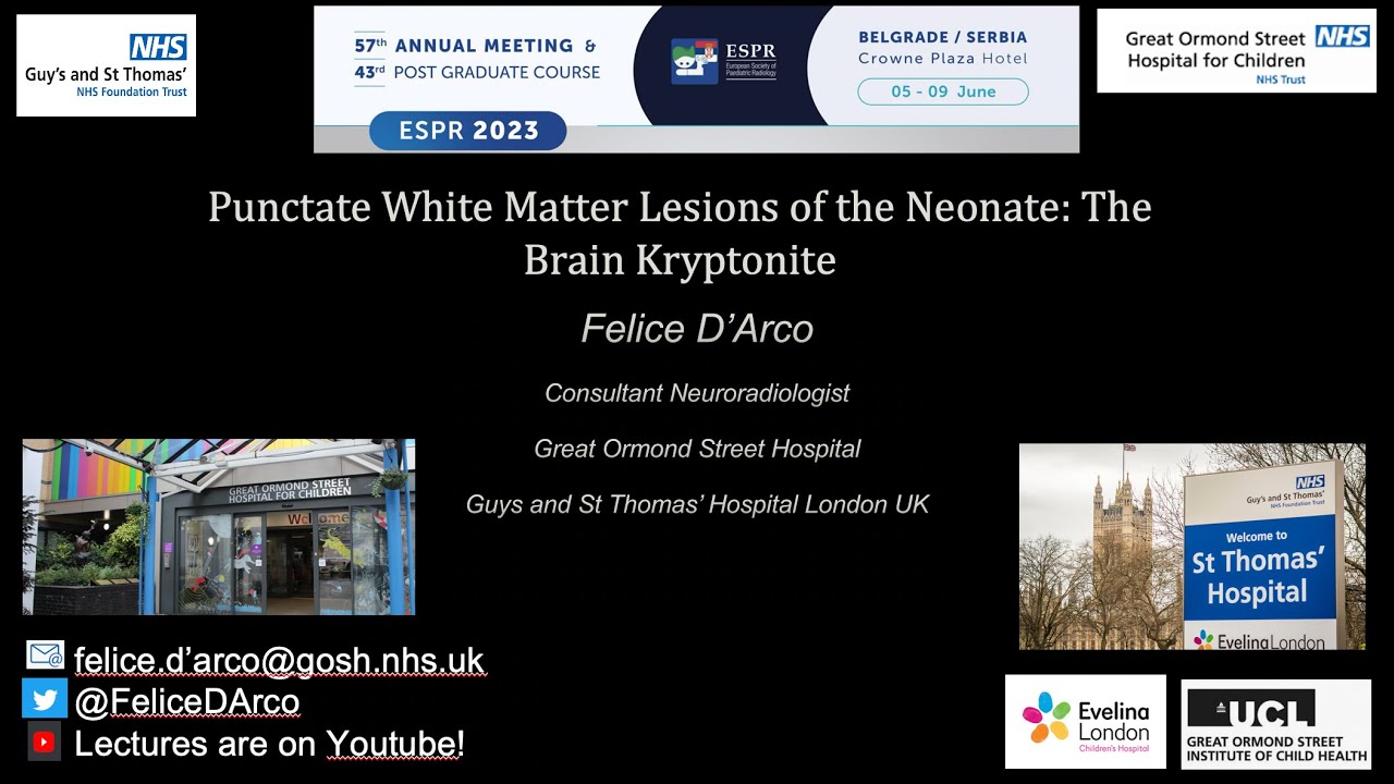 Punctate White Matter Lesions of the Neonate: what the radiologist needs to know !