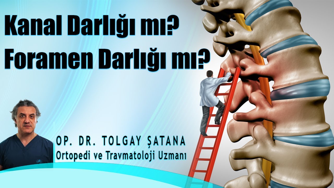 Kanal Darlığı mı? Foramen Darlığı mı?