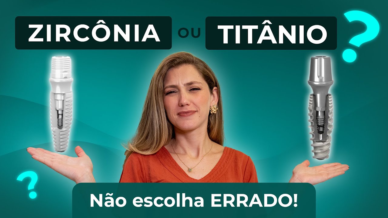Zirc&ocirc;nia ou Tit&acirc;nio: Qual Implante escolher em 2025!