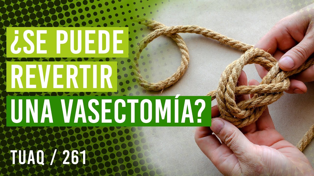 &iquest;Se puede revertir una #vasectom&iacute;a ?