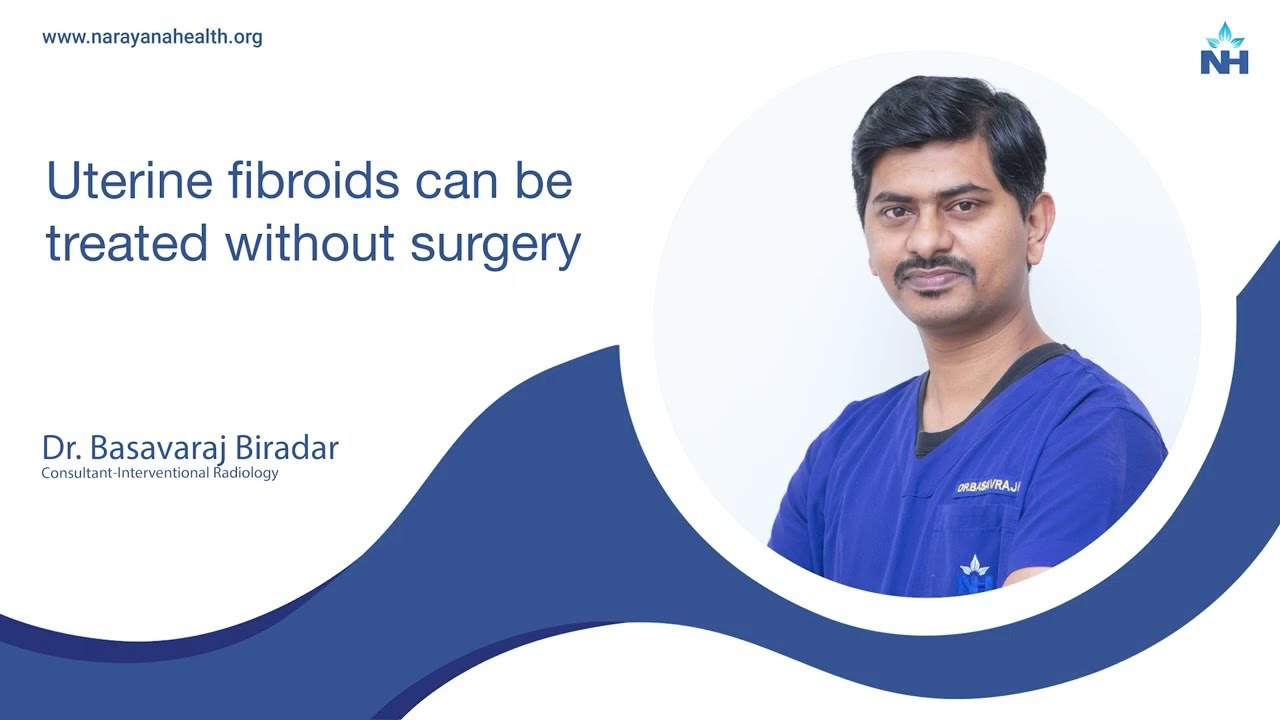 Non-Surgical Treatment for Uterine Fibroids | Dr. Basavaraj Biradar