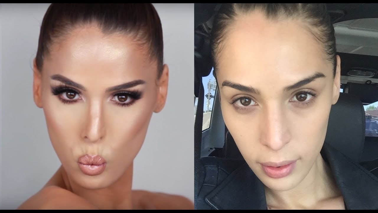 Dr. Simon Ourian Non-Surgical Nose Job | Carmen Carrera