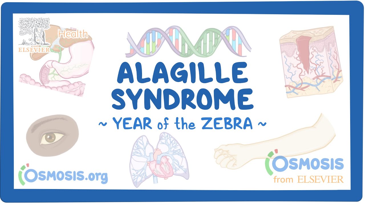 Alagille syndrome - NORD (Year of the Zebra)