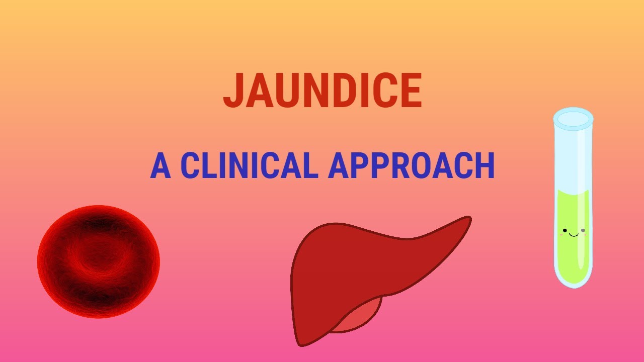 Jaundice