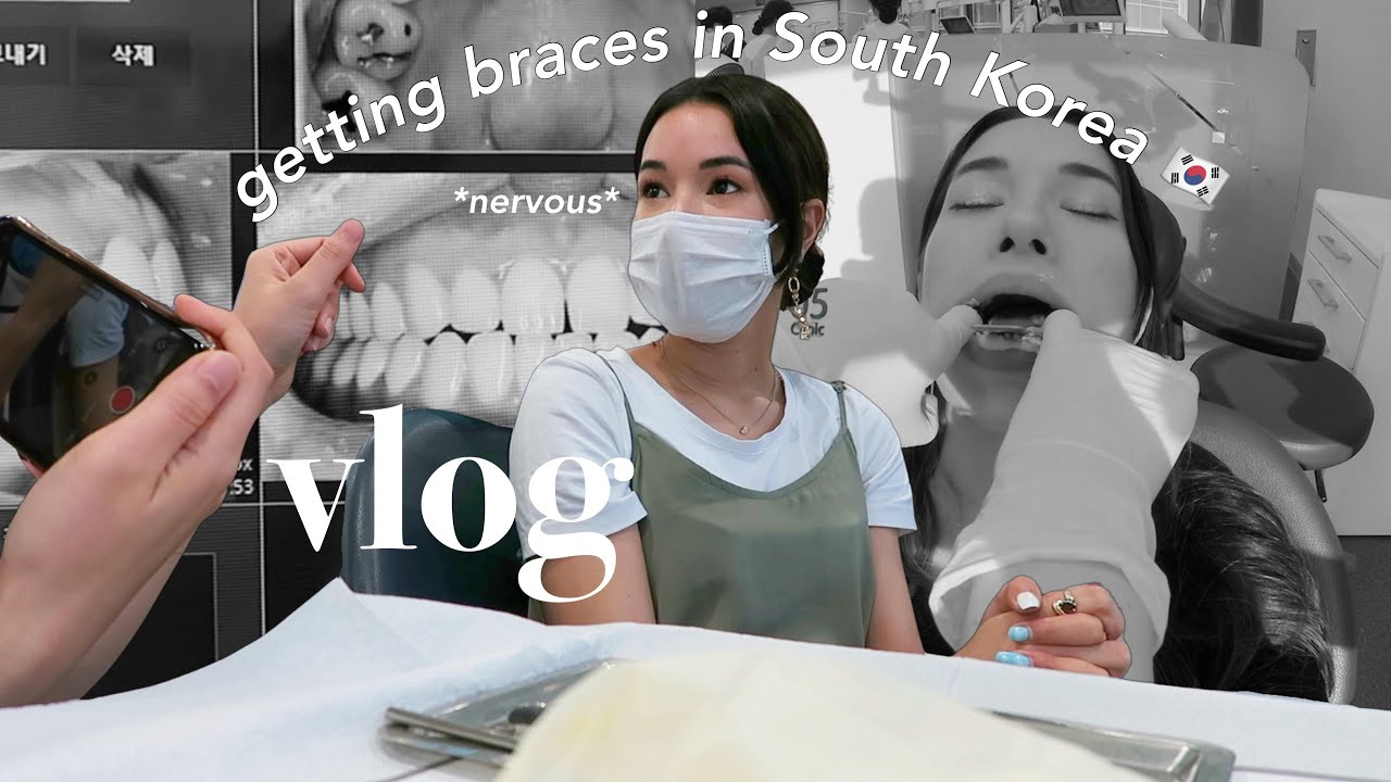 FIRST TIME GETTING BRACES IN GANGNAM, SEOUL | LIFE IN KOREA VLOG | ULINE DENTAL CLINIC