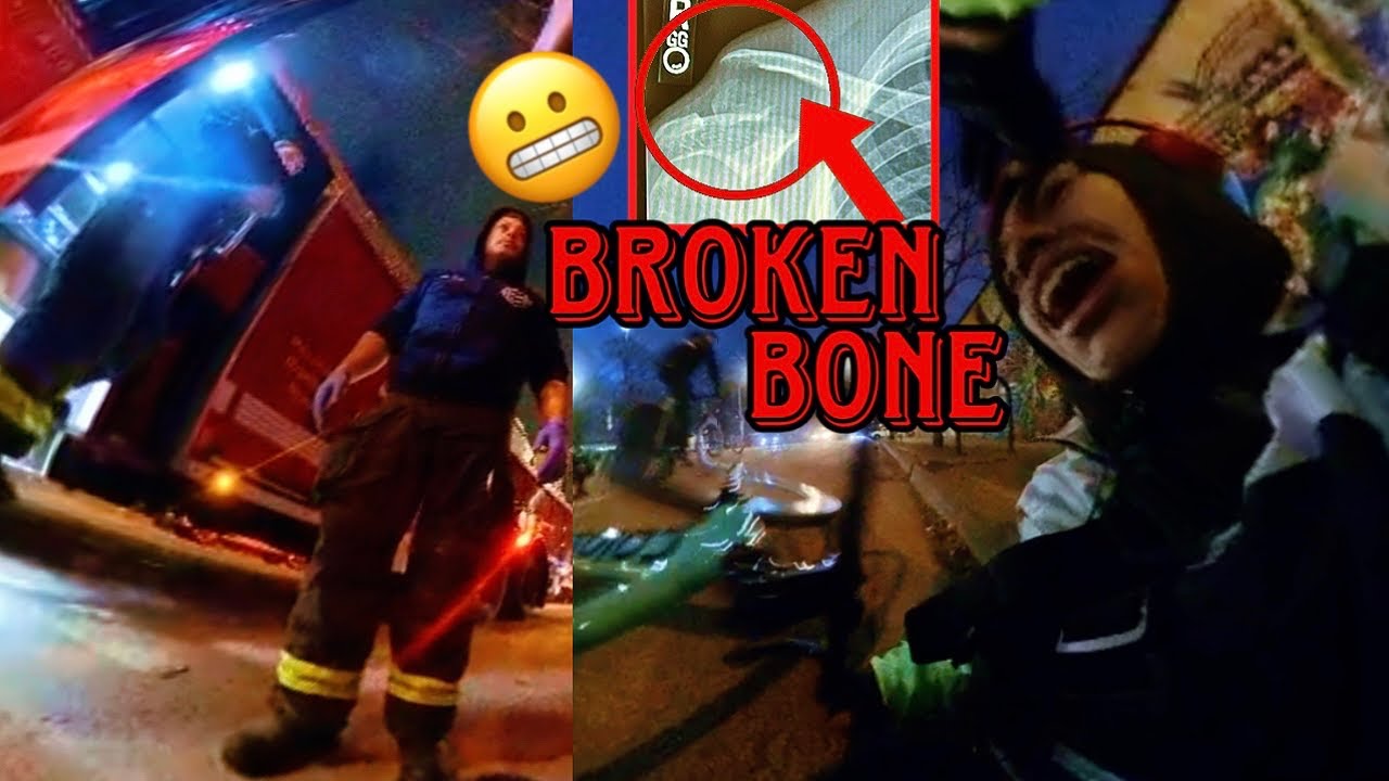 I broke my Collarbone (CRASHING OUT): fixed gear