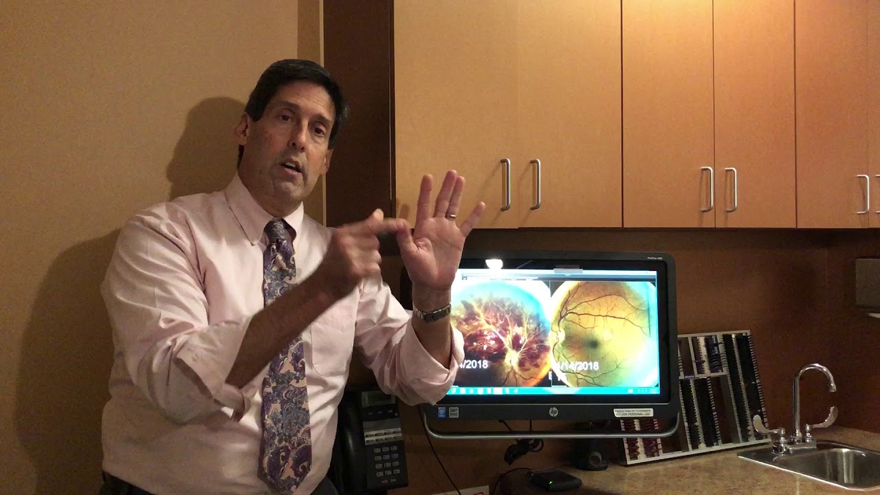 Central Retinal Vein Occlusion | Dr. Alan Mendelsohn