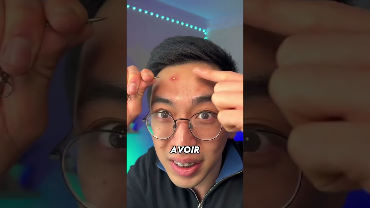 Comment se d&eacute;barrasser d'un bouton en 1 NUIT ? 🌃🌙