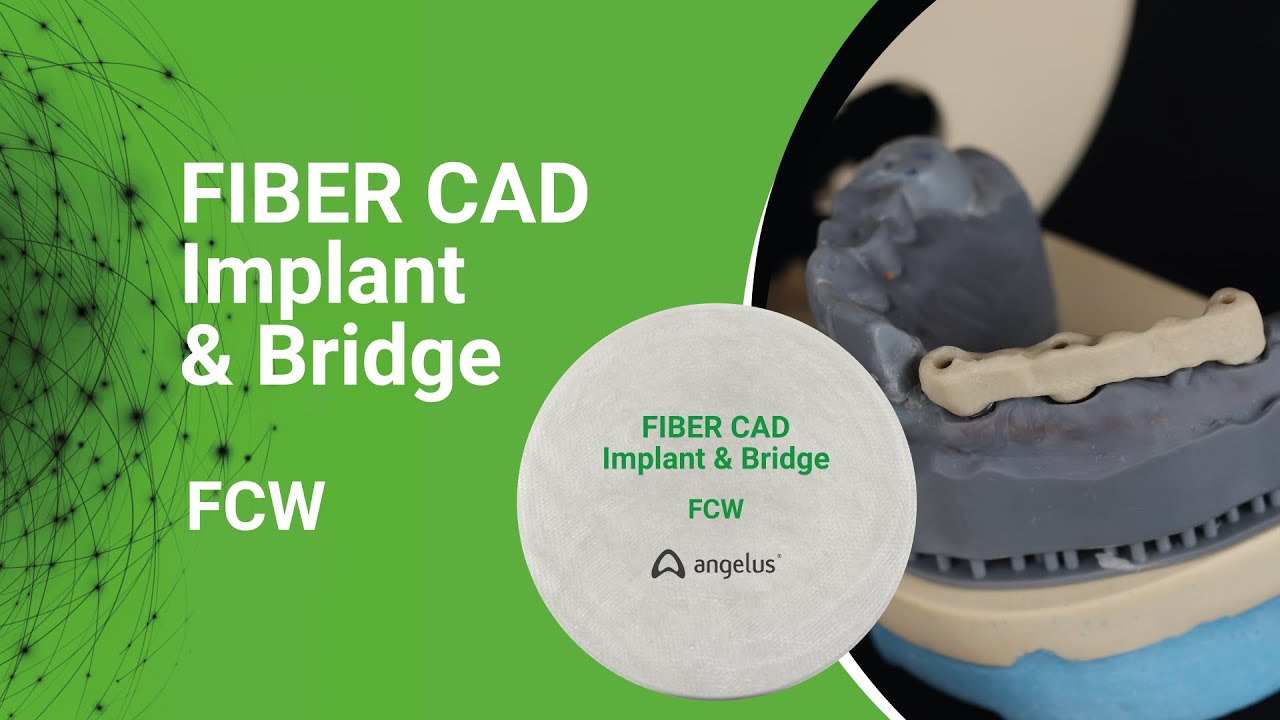 Fiber CAD Implant & Bridge: Caso Cl&iacute;nico com Disco FCW