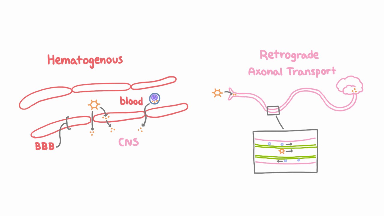 Introduction to Viral Meningitis, Encephalitis, and Meningoencephalitis