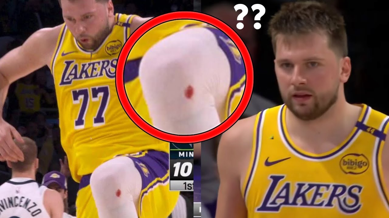 Luka Doncic Bloody Knee Mystery & NBA Playoff Injury Updates