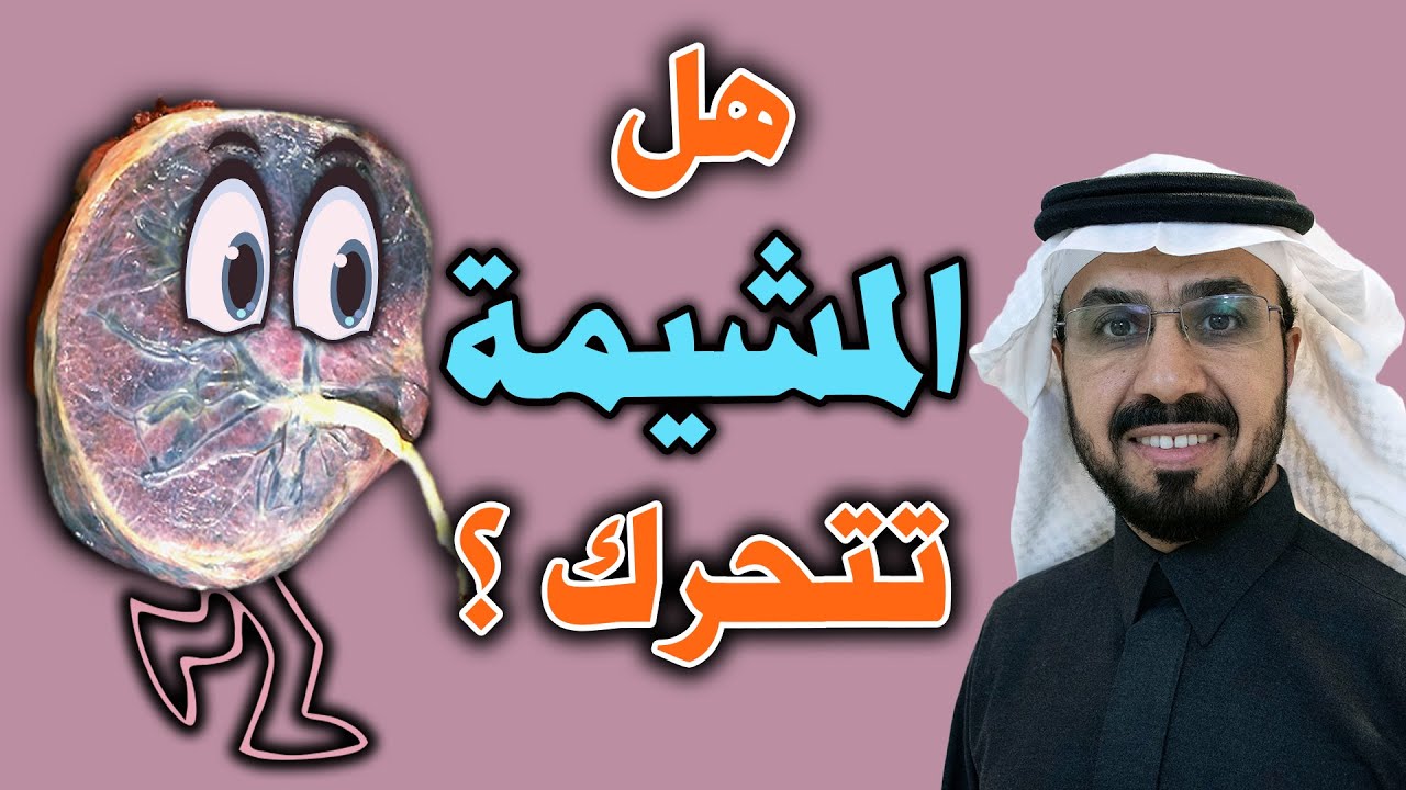 هل المشيمة تتحرك ؟ Does the placenta move?